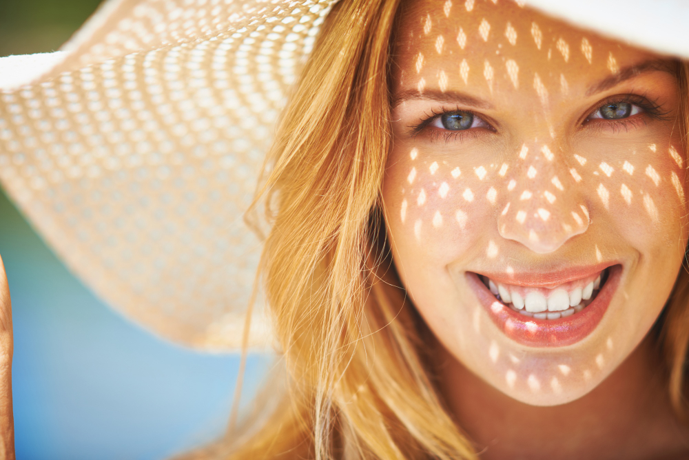 rinoplastia en verano