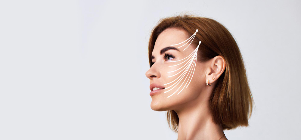 Mujer similiando lifting facial en santander